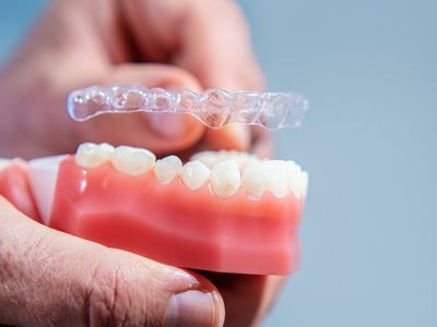 Invisalign Braces treatment in Kurnool