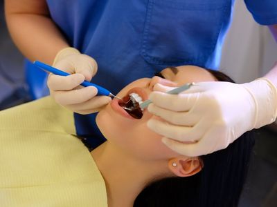 10 Biggest composite fillings Blue Springs Mistakes You Can Easily Avoid