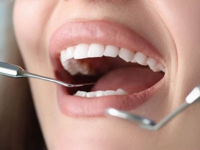 Smile Designing treatment in Kurnool