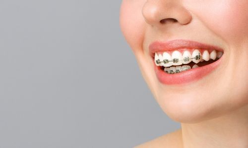 orthodontic treatment in kurnool